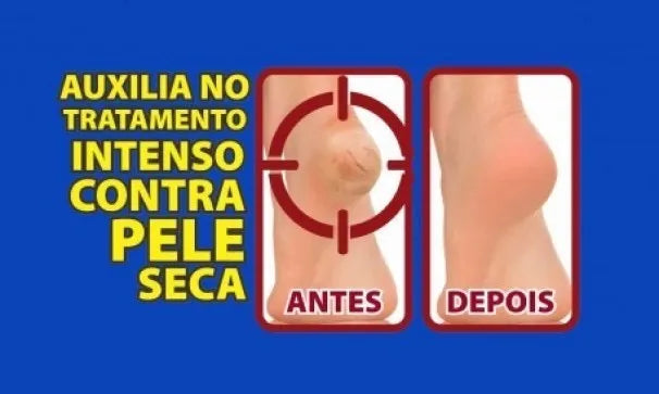 Protector Para Talon De Gel Alta Calidad 6 En 1 Ortho Pauher