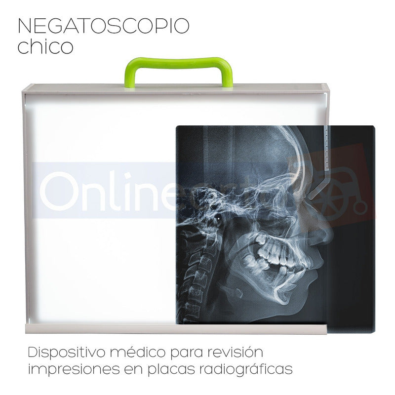 Negatoscopio Led Portátil Visualiza Radiografías